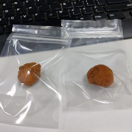 ox gallstone